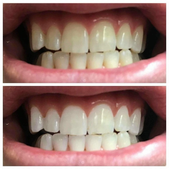 Whitening Toothpaste!! - Picture 2 of 6